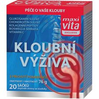 43200014_Kloubni_vyziva_WEB